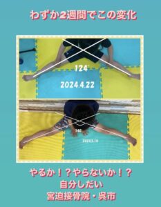 miyasako project reborn